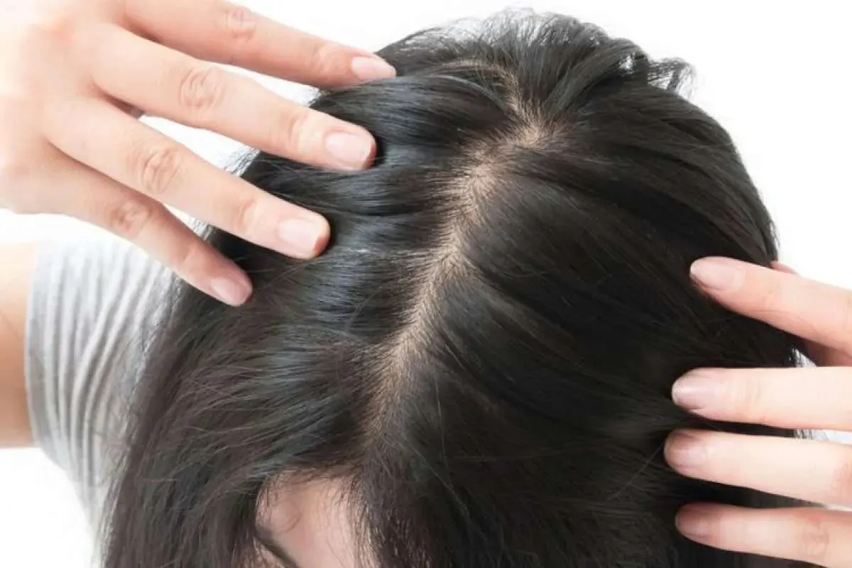 akar rambut rusak