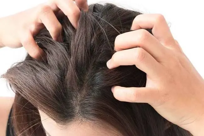 scalp gatal